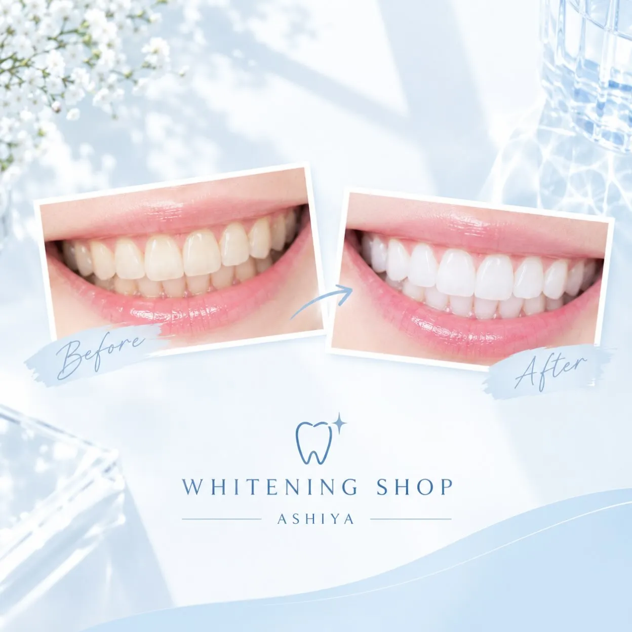 🦷 歯の色で、印象は変わる ✨